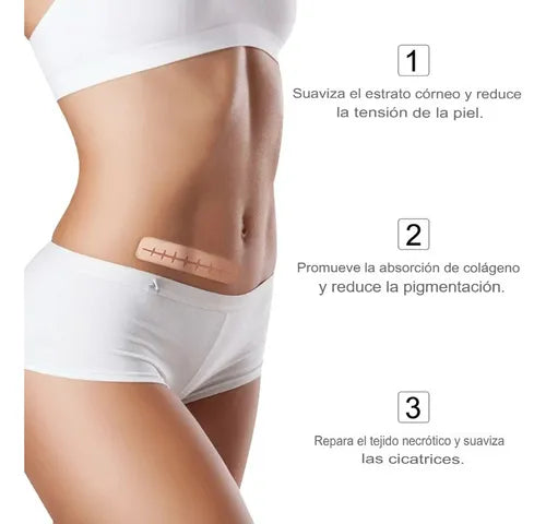 CINTA DE SILICONA PARA ELIMINAR CICATRICES 😱