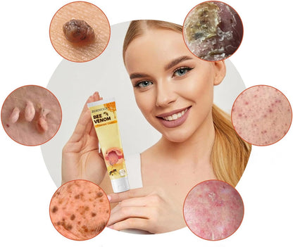 CREMA DE VENENO DE ABEJAS PARA REMOVER VERRUGAS, LUNARES, MANCHAS EN LA PIEL